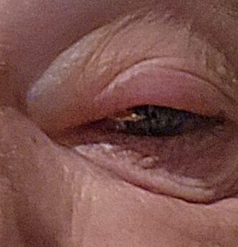 Well this sucks!  Visiting a doctor internationally,